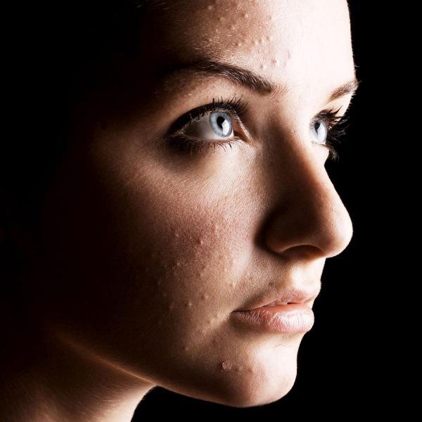 «Лактофильтрум» для кожи лица: отзывы, инструкция по применению, состав препарата