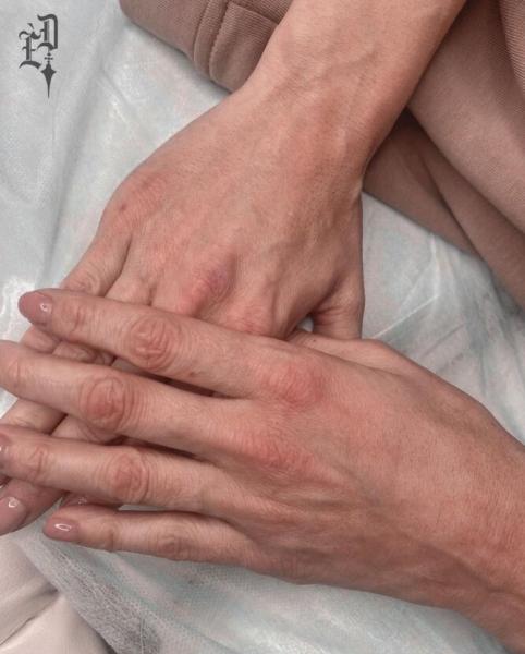 Как будут выглядеть руки после контурной пластики – средства против сухости и старения кожи