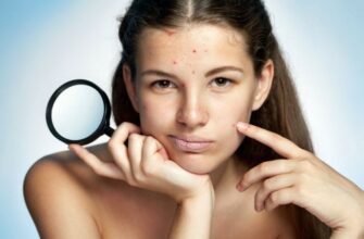 7 ошибок в уходе за кожей, которые приводят к появлению прыщей