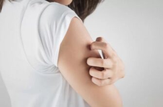 Дерматит – классификация и связь с другими заболеваниями