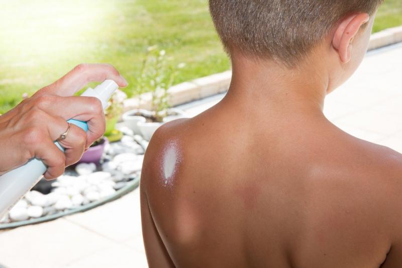 Солнечные ожоги у детей: чем помочь, причины и симптомы Солнечные ожоги у детей: как лечить, причины и симптомы